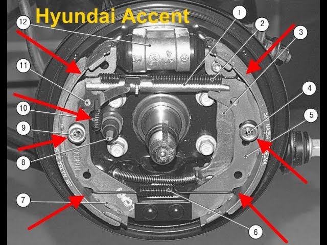 ბალიშების გამოცვლა Hyundai Accent-ზე
