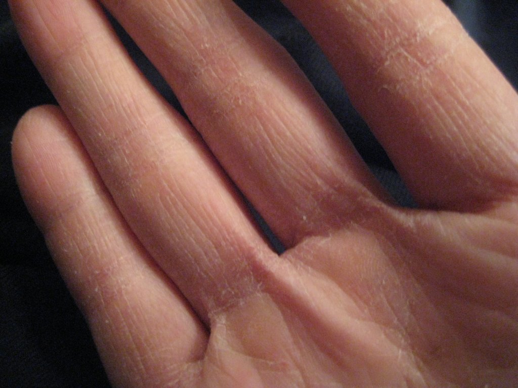 Como gardar as mans secas?