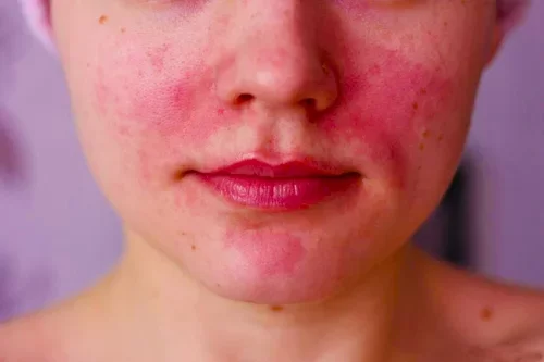 Косметика, не вызывающая аллергии – как ее найти?