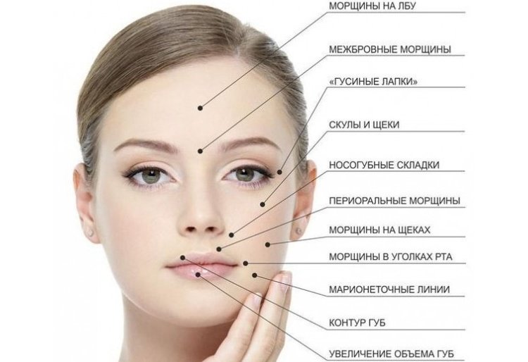 Mesotherapy - what is it? Home mesotherapy step by step