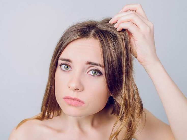 Жирные волосы &#8211; предлагаем, как справиться с проблемой жирных волос